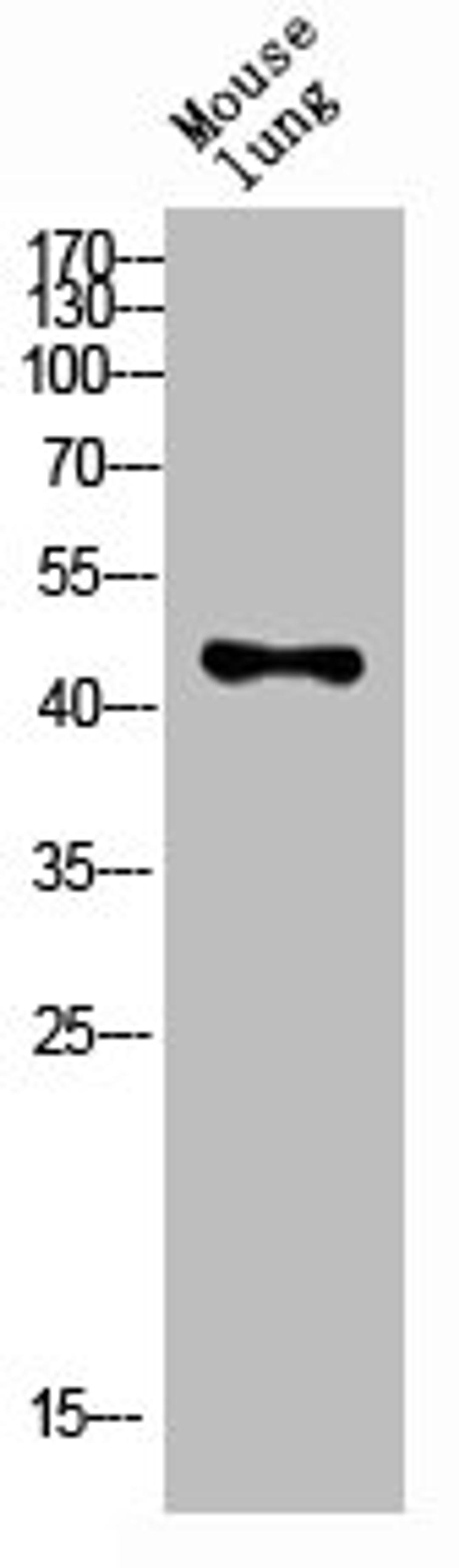 Western blot analysis of mouse-lung lysis using KIR3DL1 antibody. Antibody was diluted at 1:1000. Secondary antibody  was diluted at 1:20000