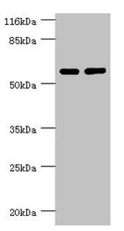 Western blot. All lanes: PPP2R5C antibody at 1.31ug/ml. Lane 1: MM231 whole cell lysate. Lane 2: K562 whole cell lysate. Secondary. Goat polyclonal to rabbit IgG at 1/10000 dilution. Predicted band size: 62, 53, 57, 63, 65 kDa. Observed band size: 62 kDa. 