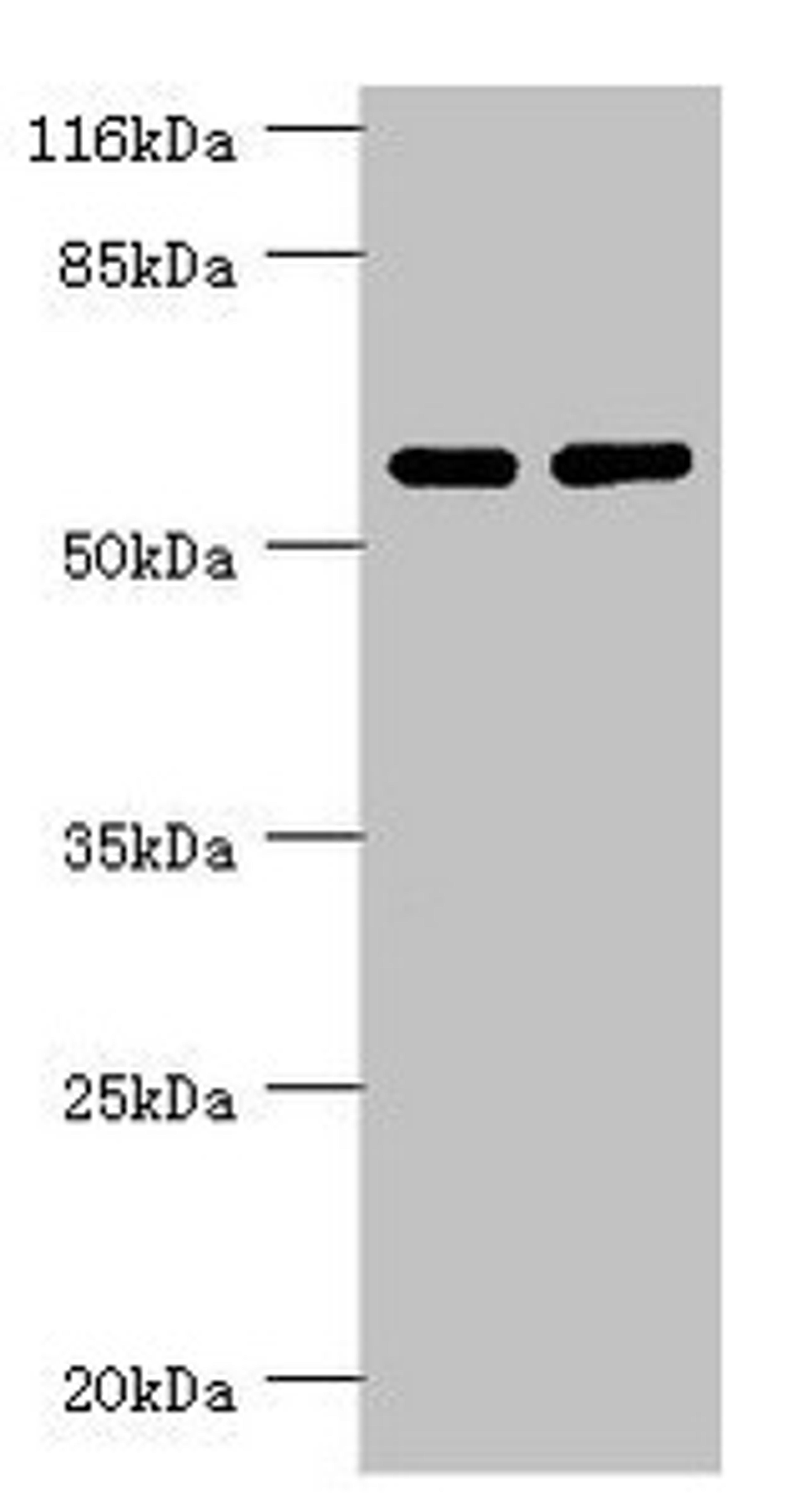 Western blot. All lanes: PPP2R5C antibody at 1.31ug/ml. Lane 1: MM231 whole cell lysate. Lane 2: K562 whole cell lysate. Secondary. Goat polyclonal to rabbit IgG at 1/10000 dilution. Predicted band size: 62, 53, 57, 63, 65 kDa. Observed band size: 62 kDa. 