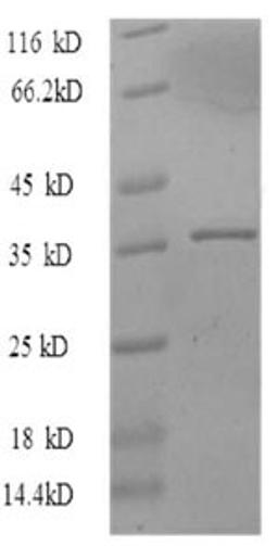 (Tris-Glycine gel) Discontinuous SDS-PAGE (reduced) with 5% enrichment gel and 15% separation gel.