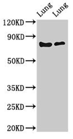 Western Blot. Positive WB detected in: Rat lung tissue, Mouse lung tissue. All lanes: FOXP1 antibody at 2ug/ml. Secondary. Goat polyclonal to rabbit IgG at 1/50000 dilution. Predicted band size: 76, 55, 66, 75, 13, 67, 78 kDa. Observed band size: 76 kDa. 