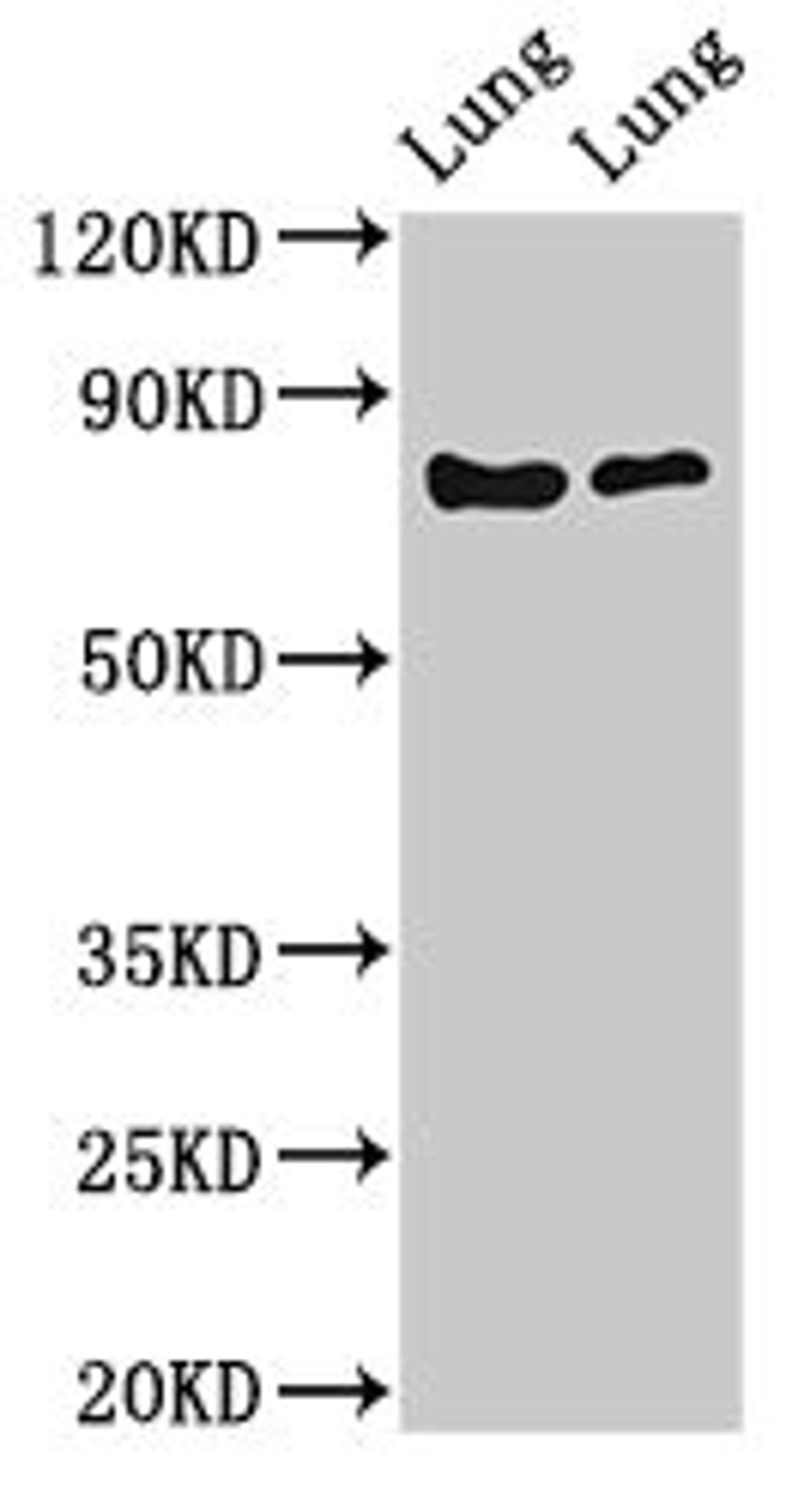 Western Blot. Positive WB detected in: Rat lung tissue, Mouse lung tissue. All lanes: FOXP1 antibody at 2ug/ml. Secondary. Goat polyclonal to rabbit IgG at 1/50000 dilution. Predicted band size: 76, 55, 66, 75, 13, 67, 78 kDa. Observed band size: 76 kDa. 