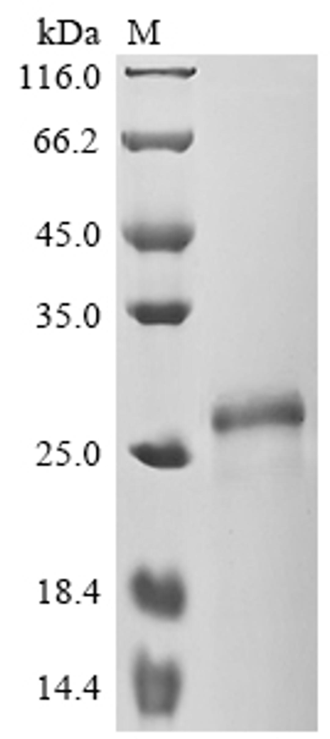 (Tris-Glycine gel) Discontinuous SDS-PAGE (reduced) with 5% enrichment gel and 15% separation gel.