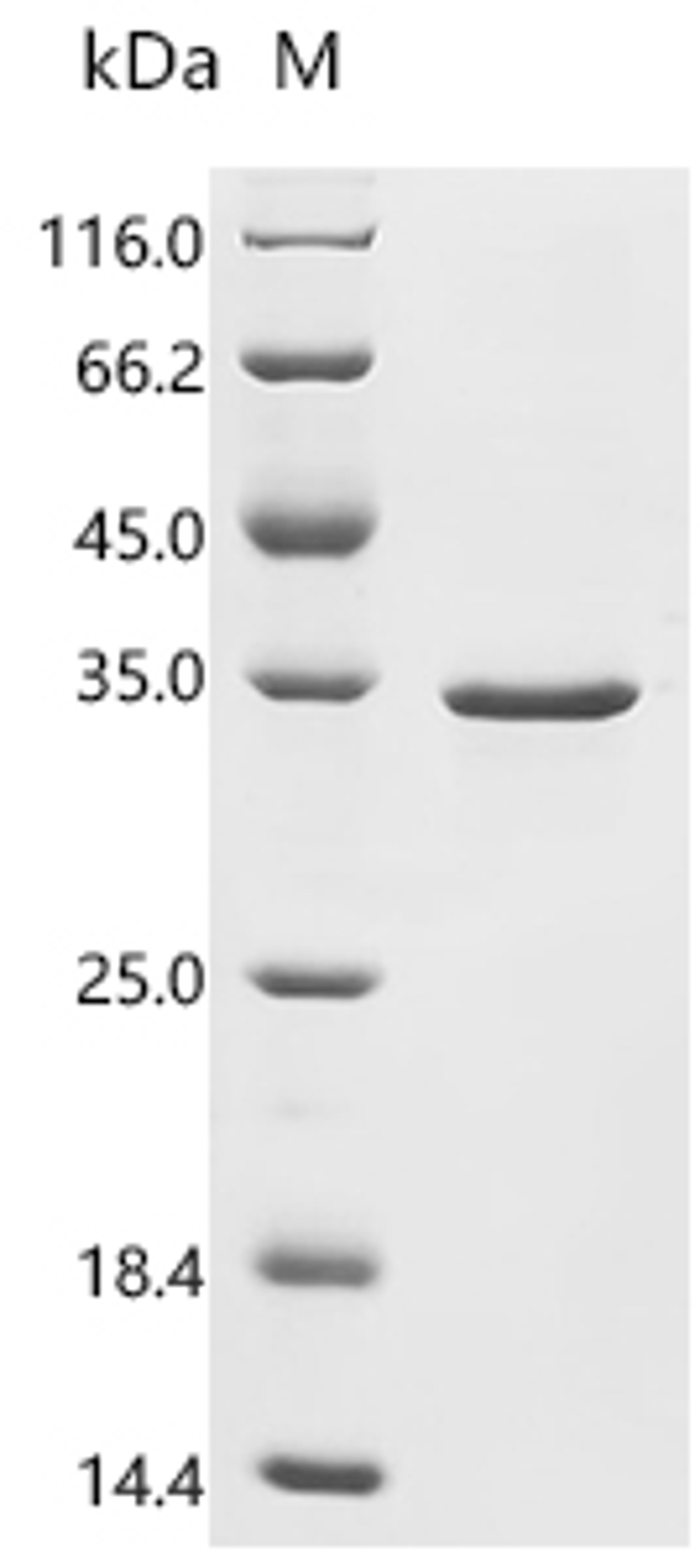 (Tris-Glycine gel) Discontinuous SDS-PAGE (reduced) with 5% enrichment gel and 15% separation gel.