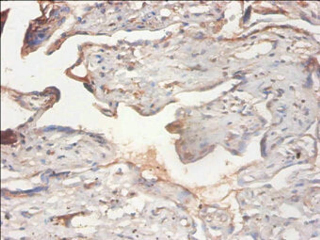 Immunohistochemistry of paraffin-embedded human placenta tissue using CSB-PA017915EA01HU at dilution of 1:100