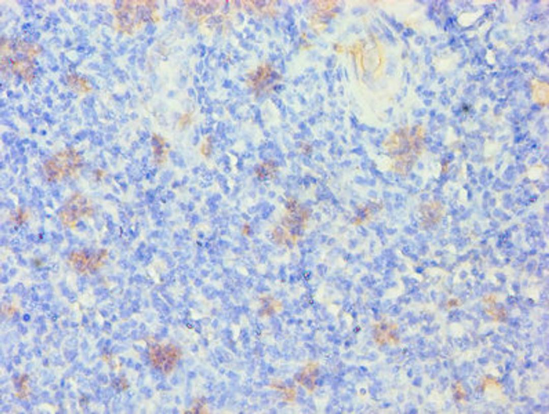 Immunohistochemistry of paraffin-embedded human tonsil tissue using CSB-PA012512LA01HU at dilution of 1:100
