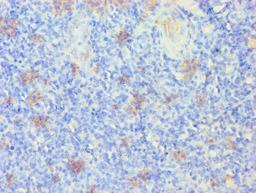 Immunohistochemistry of paraffin-embedded human tonsil tissue using CSB-PA012512LA01HU at dilution of 1:100