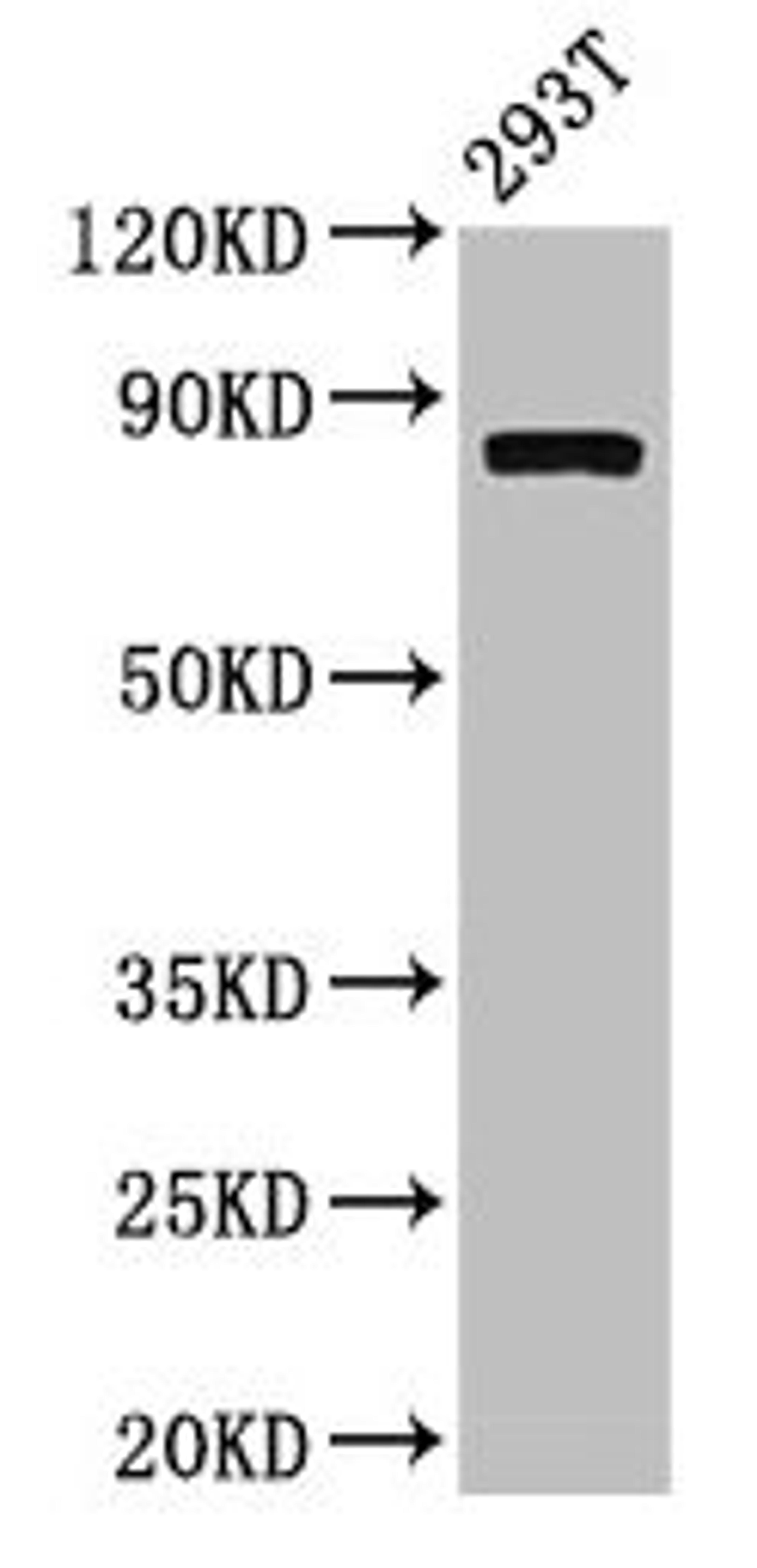 Western Blot. Positive WB detected in: 293T whole cell lysate. All lanes: CAPN2 antibody at 3.4µg/ml. Secondary. Goat polyclonal to rabbit IgG at 1/50000 dilution. Predicted band size: 80, 72 kDa. Observed band size: 80 kDa