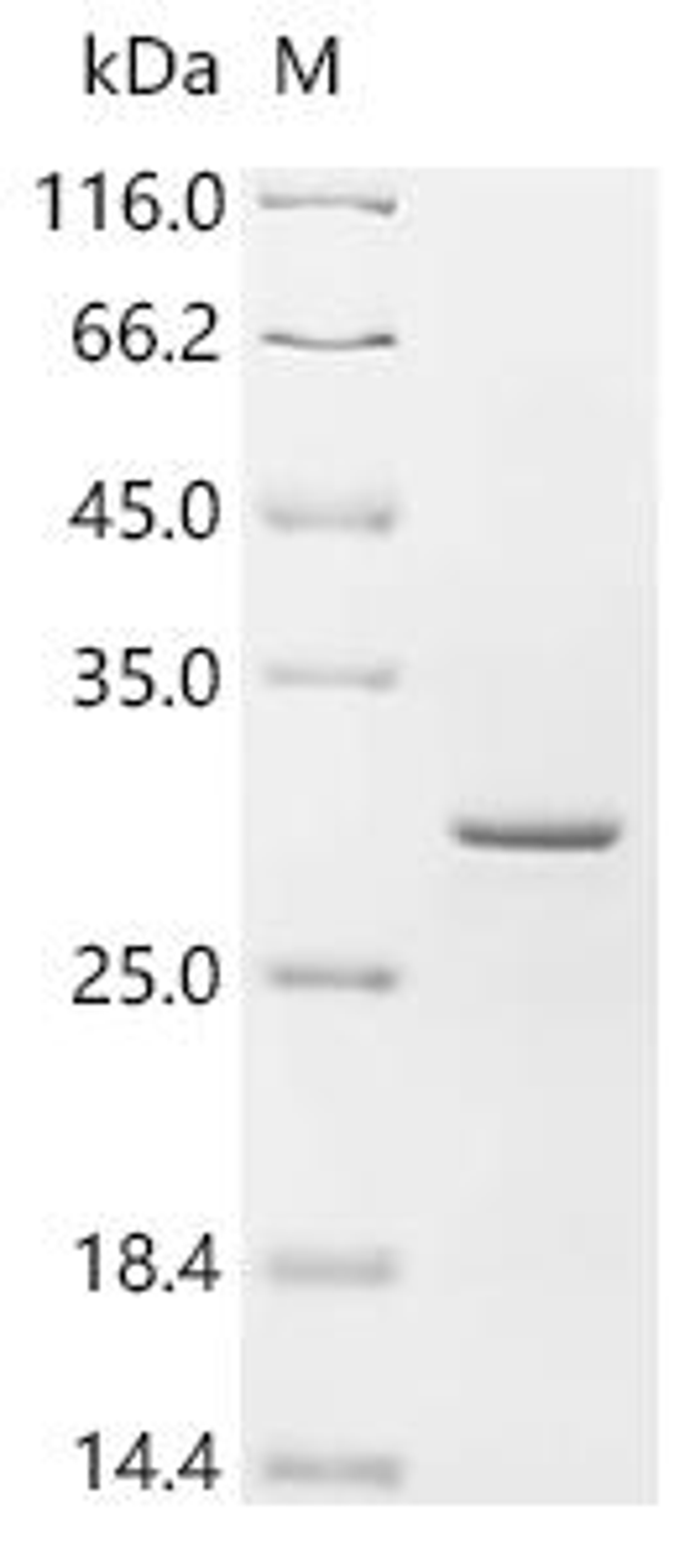 (Tris-Glycine gel) Discontinuous SDS-PAGE (reduced) with 5% enrichment gel and 15% separation gel.