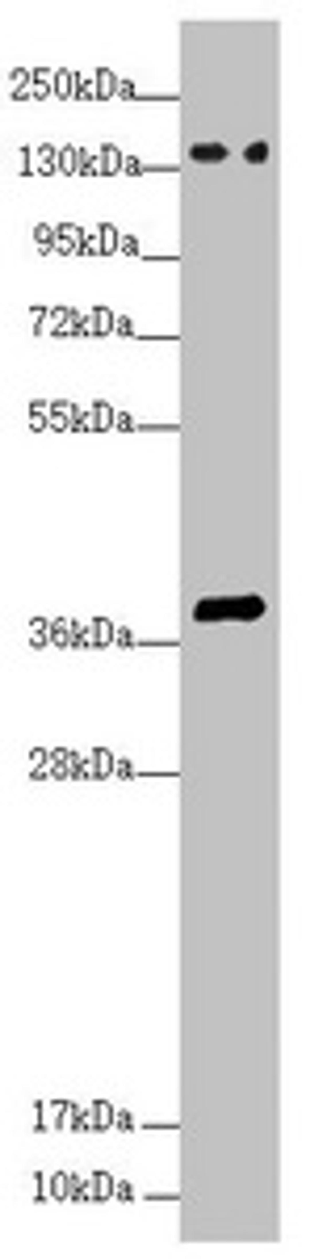 Western blot. All lanes: SFI1 antibody at 4.26 ug/ml + HepG2 whole cell lysate. Secondary. Goat polyclonal to rabbit IgG at 1/10000 dilution. Predicted band size: 148, 144, 139, 122, 118, 142, 137 kDa. Observed band size: 148, 38 kDa. 