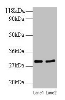 Western blot. All lanes: RPL8 antibody at 2µg/ml. Lane 1: EC109 whole cell lysate. Lane 2: 293T whole cell lysate. Secondary. Goat polyclonal to rabbit IgG at 1/10000 dilution. Predicted band size: 29 kDa. Observed band size: 29 kDa