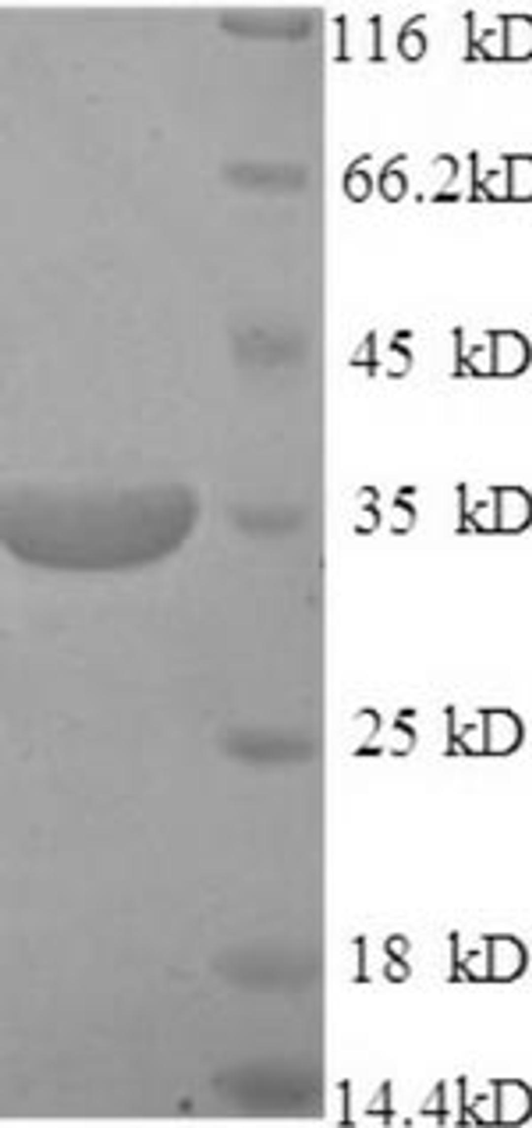(Tris-Glycine gel) Discontinuous SDS-PAGE (reduced) with 5% enrichment gel and 15% separation gel.