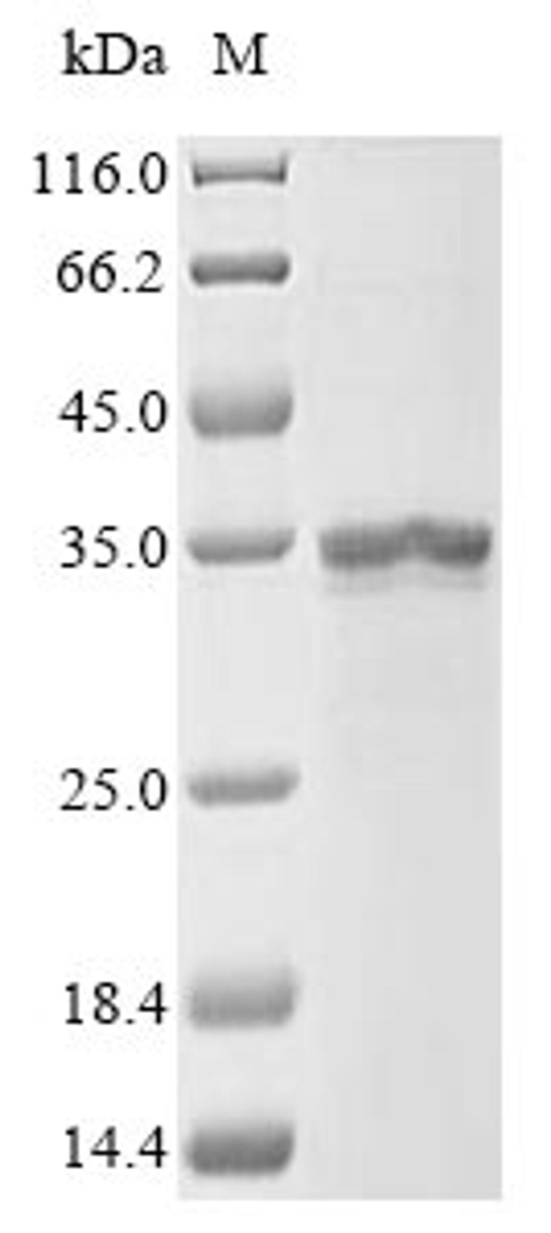 (Tris-Glycine gel) Discontinuous SDS-PAGE (reduced) with 5% enrichment gel and 15% separation gel.