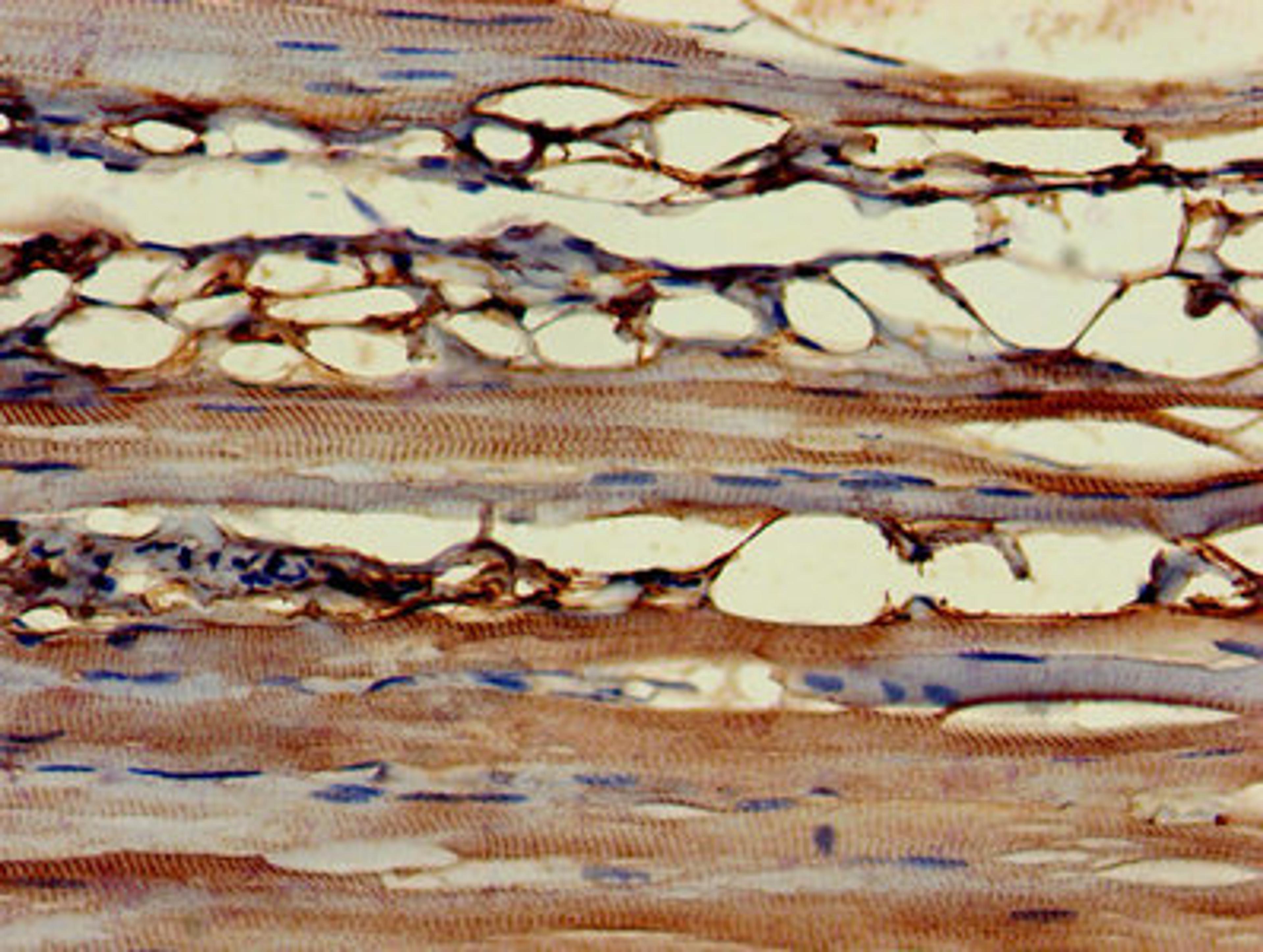 Immunohistochemistry of paraffin-embedded human skeletal muscle tissue using CSB-PA006376LA01HU at dilution of 1:100
