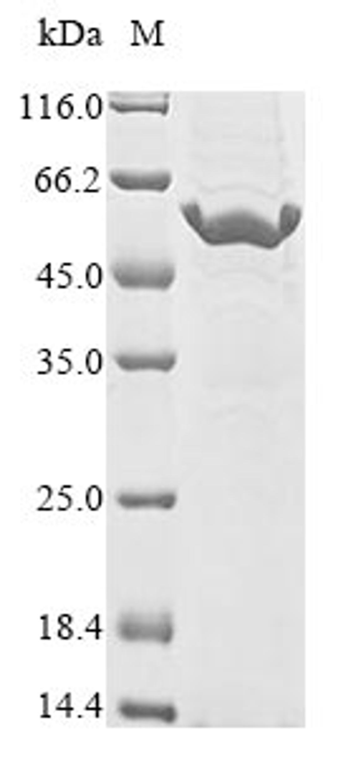 (Tris-Glycine gel) Discontinuous SDS-PAGE (reduced) with 5% enrichment gel and 15% separation gel.