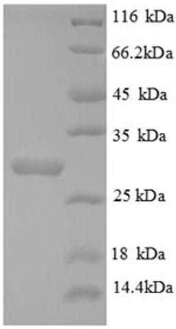 (Tris-Glycine gel) Discontinuous SDS-PAGE (reduced) with 5% enrichment gel and 15% separation gel.