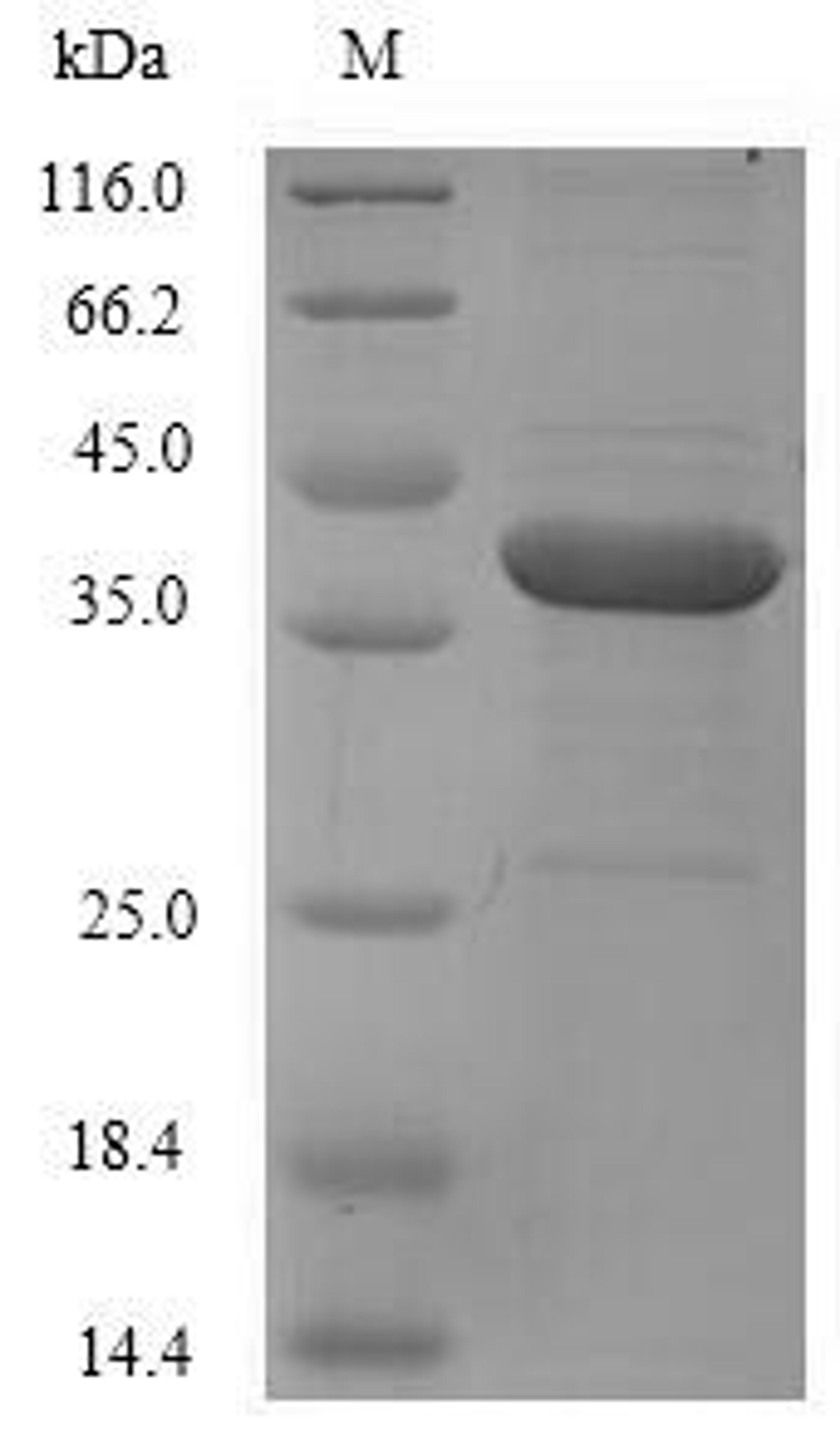 (Tris-Glycine gel) Discontinuous SDS-PAGE (reduced) with 5% enrichment gel and 15% separation gel.