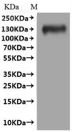 CSB-MP621688HU(A5)(M)  is detected by Mouse anti-6*His monoclonal antibody.