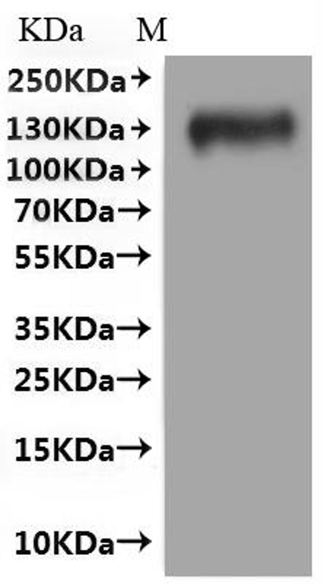 CSB-MP621688HU(A5)(M) is detected by Mouse anti-6*His monoclonal antibody.