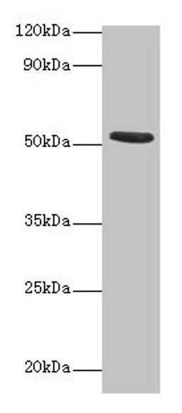 Western blot. All lanes: CHRNA1 antibody at 2µg/ml + Recombinant Acetylcholine receptor subunit alpha protein 0.1µg. Secondary. Goat polyclonal to rabbit IgG at 1/15000 dilution. Predicted band size: 53 kDa. Observed band size: 53 kDa