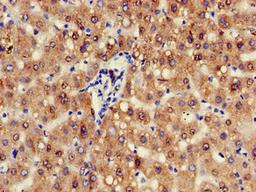 Immunohistochemistry of paraffin-embedded human liver tissue using CSB-PA739009HA01HU at dilution of 1:100