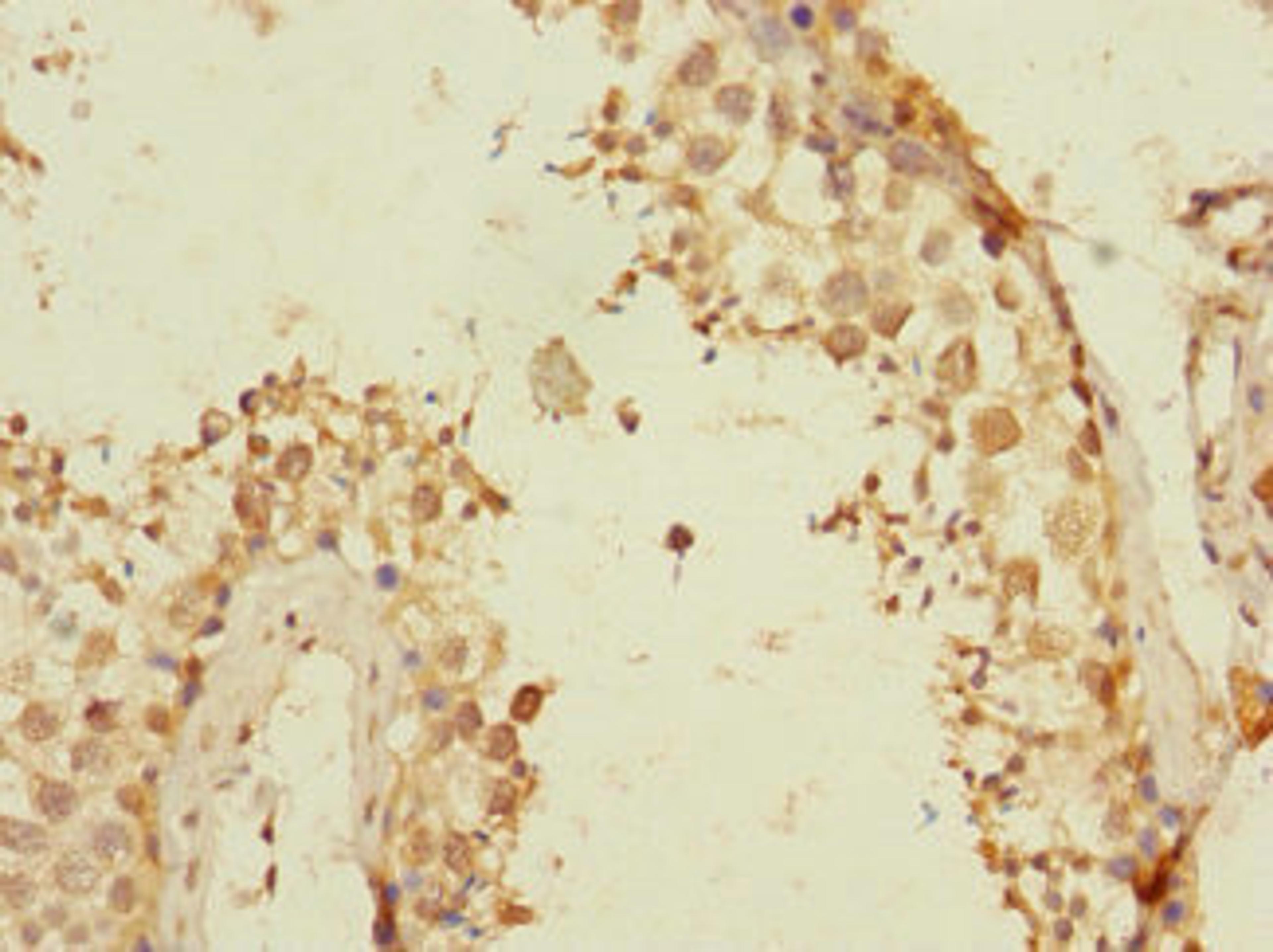 Immunohistochemistry of paraffin-embedded human testis tissue using CSB-PA765062LA01HU at dilution of 1:100