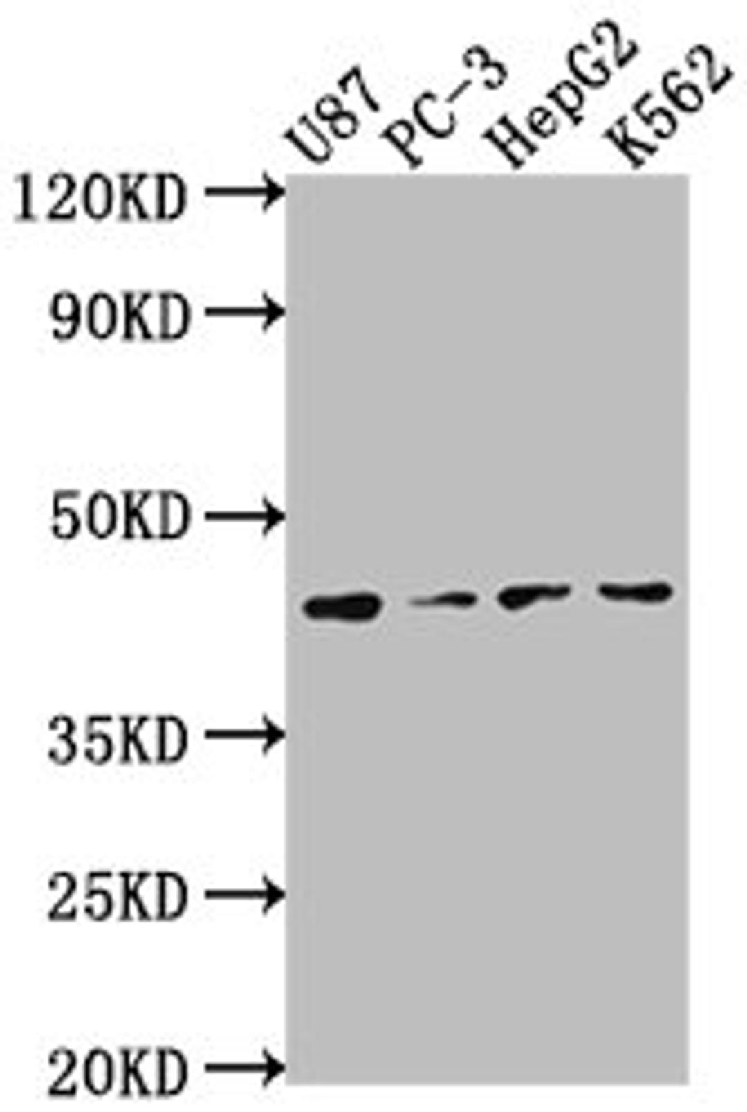 Western Blot. Positive WB detected in: U87 whole cell lysate, PC-3 whole cell lysate, HepG2 whole cell lysate, K562 whole cell lysate. All lanes: OPCML antibody at 1:2000. Secondary. Goat polyclonal to rabbit IgG at 1/50000 dilution. Predicted band size: 39, 38, 34 kDa. Observed band size: 39 kDa. 