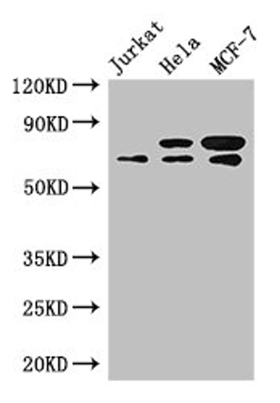 Western Blot. Positive WB detected in: Jurkat whole cell lysate, Hela whole cell lysate, MCF-7 whole cell lysate. All lanes: INTS9 antibody at 3.4ug/ml. Secondary. Goat polyclonal to rabbit IgG at 1/50000 dilution. Predicted band size: 74, 72 kDa. Observed band size: 74, 72 kDa. 