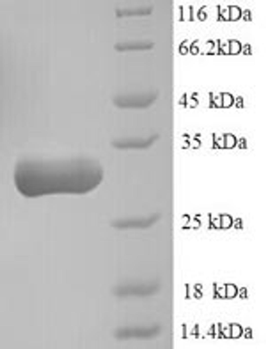 (Tris-Glycine gel) Discontinuous SDS-PAGE (reduced) with 5% enrichment gel and 15% separation gel.