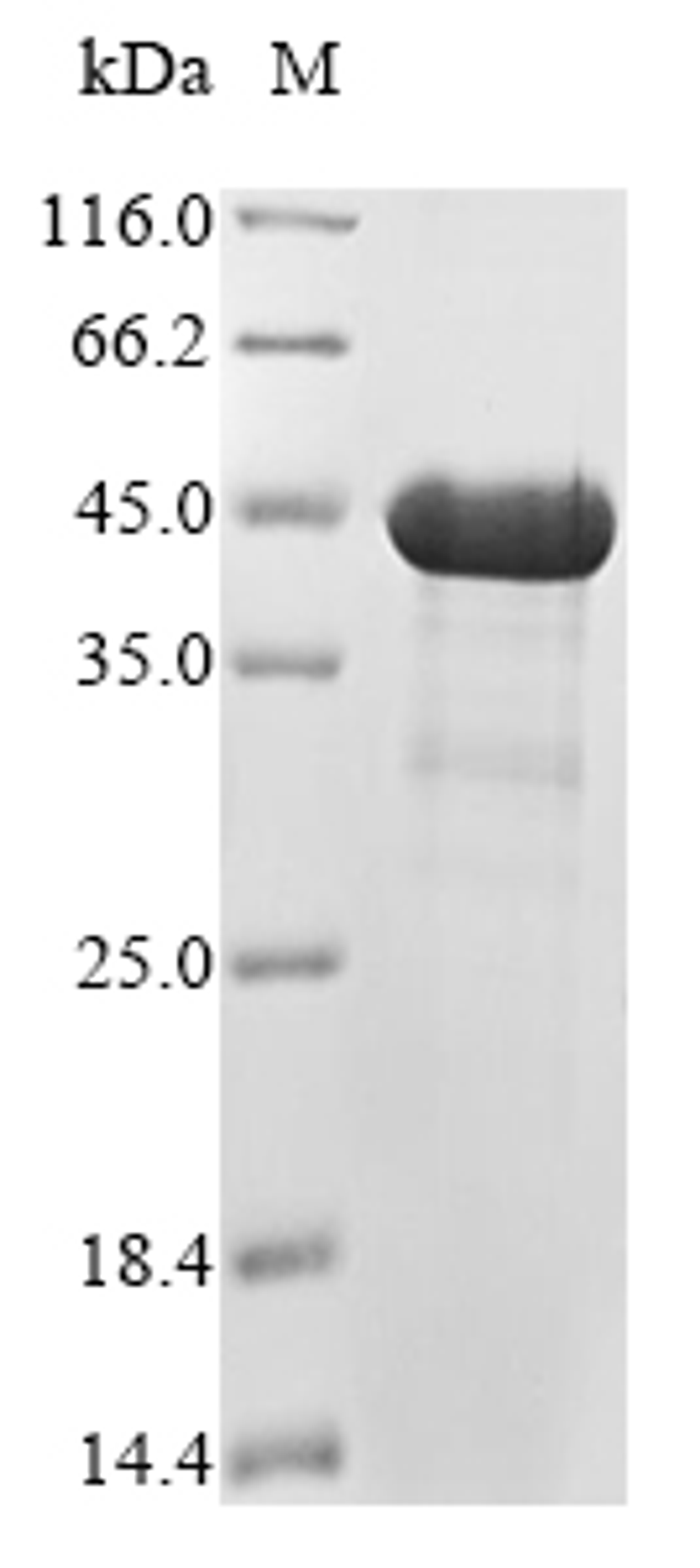 (Tris-Glycine gel) Discontinuous SDS-PAGE (reduced) with 5% enrichment gel and 15% separation gel.