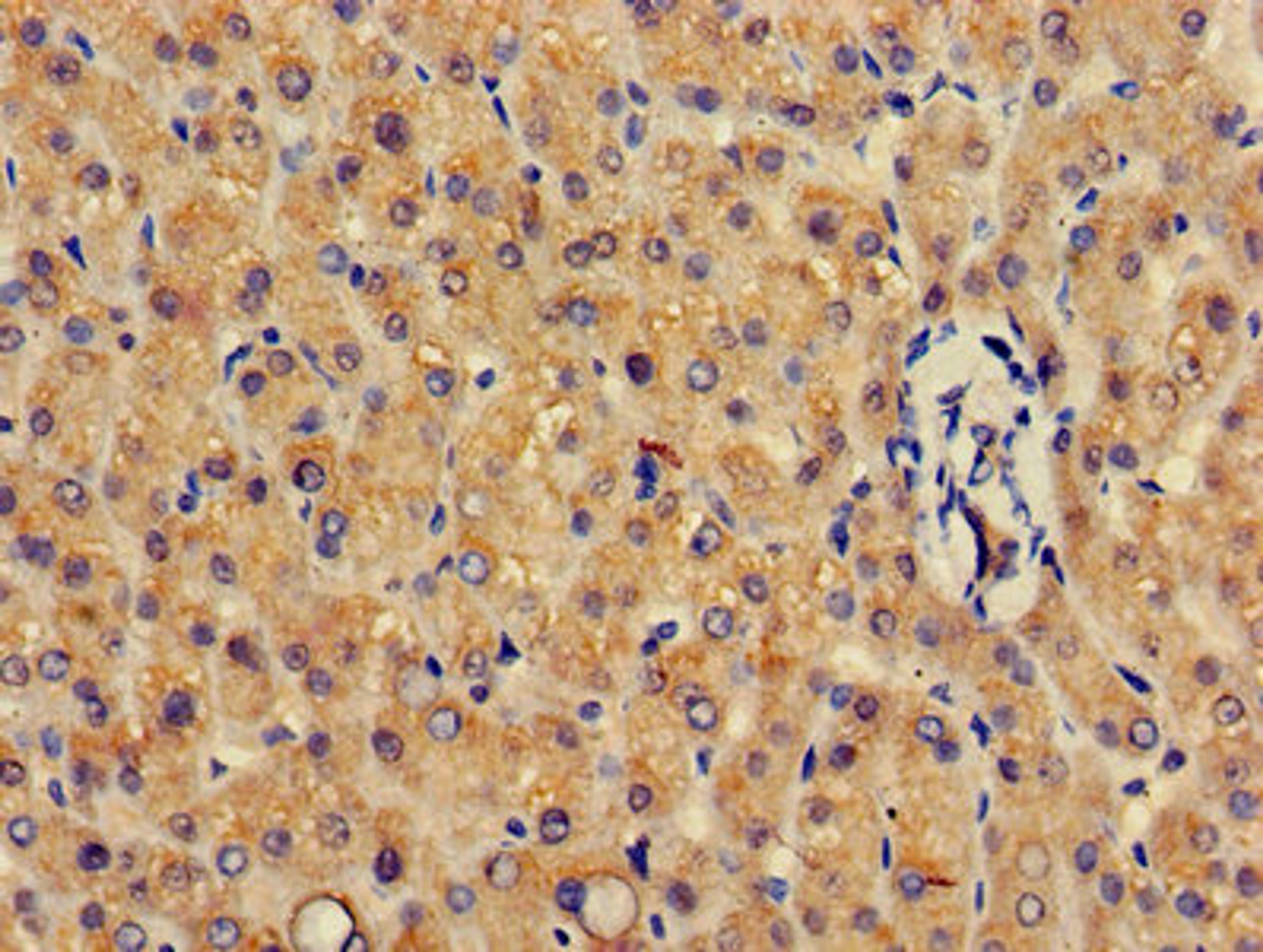 Immunohistochemistry of paraffin-embedded human liver tissue using CSB-PA009973HA01HU at dilution of 1:100