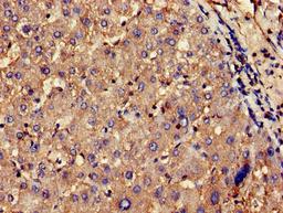 Immunohistochemistry of paraffin-embedded human liver tissue using CSB-PA005653LA01HU at dilution of 1:100