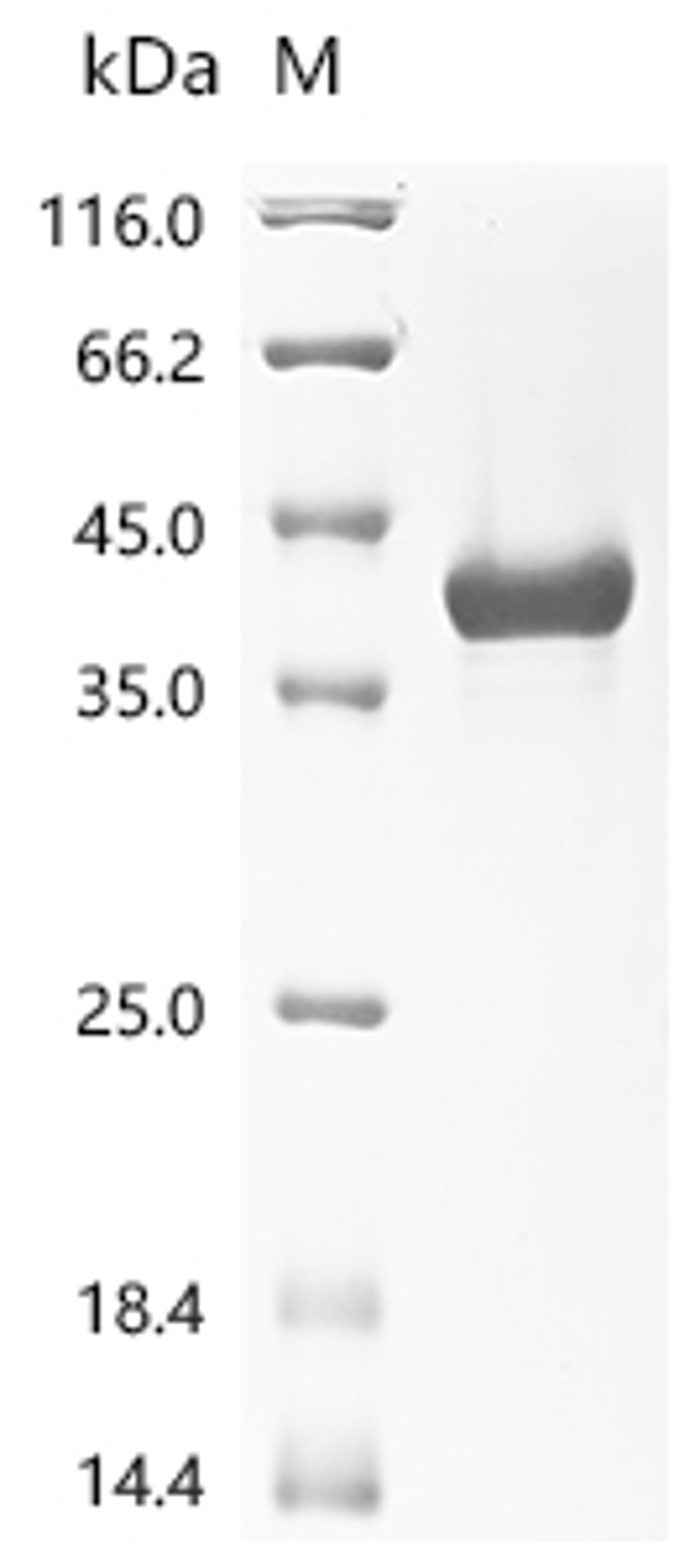 (Tris-Glycine gel) Discontinuous SDS-PAGE (reduced) with 5% enrichment gel and 15% separation gel.