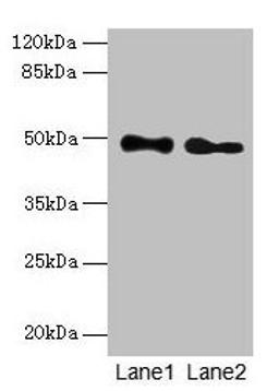 Western blot. All lanes: ABHD2 antibody at 10µg/ml. Lane 1: Mouse heart tissue. Lane 2: Rat gonadal tissue. Secondary. Goat polyclonal to rabbit IgG at 1/10000 dilution. Predicted band size: 49 kDa. Observed band size: 49 kDa