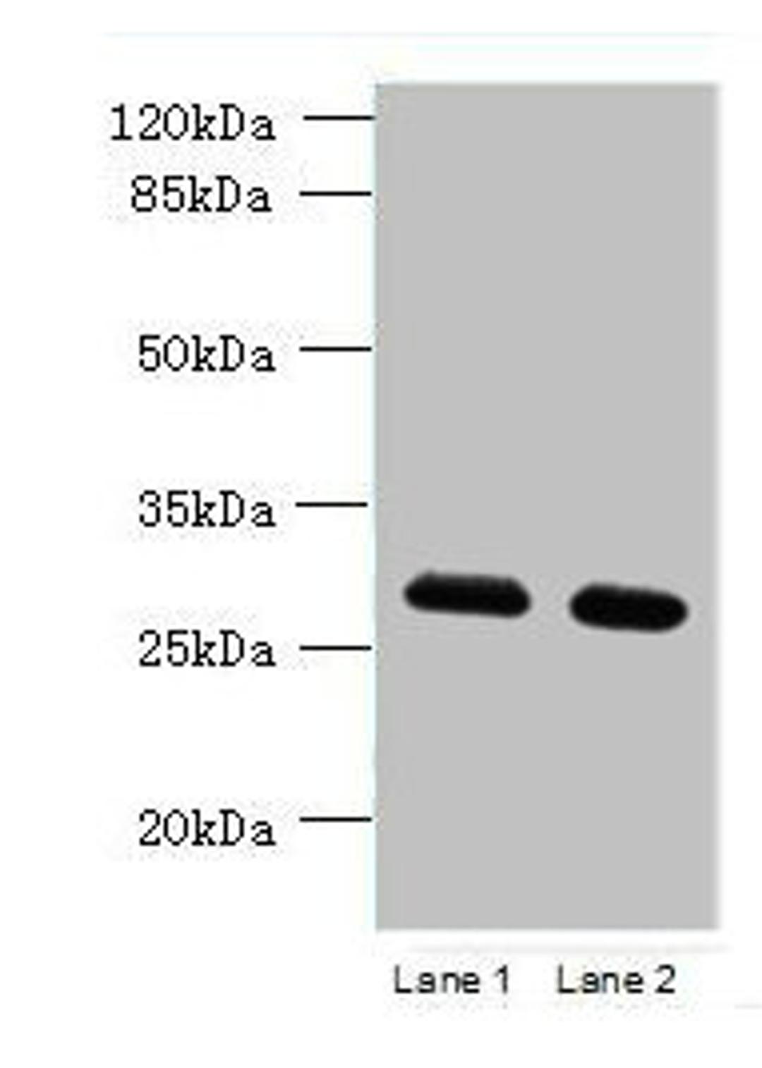 Western blot. All lanes: TMEM38B antibody at 1.5ug/ml. Lane 1: Mouse thymus tissue. Lane 2: Mouse liver tissue. Secondary. Goat polyclonal to rabbit IgG at 1/10000 dilution. Predicted band size: 33 kDa. Observed band size: 33 kDa. 