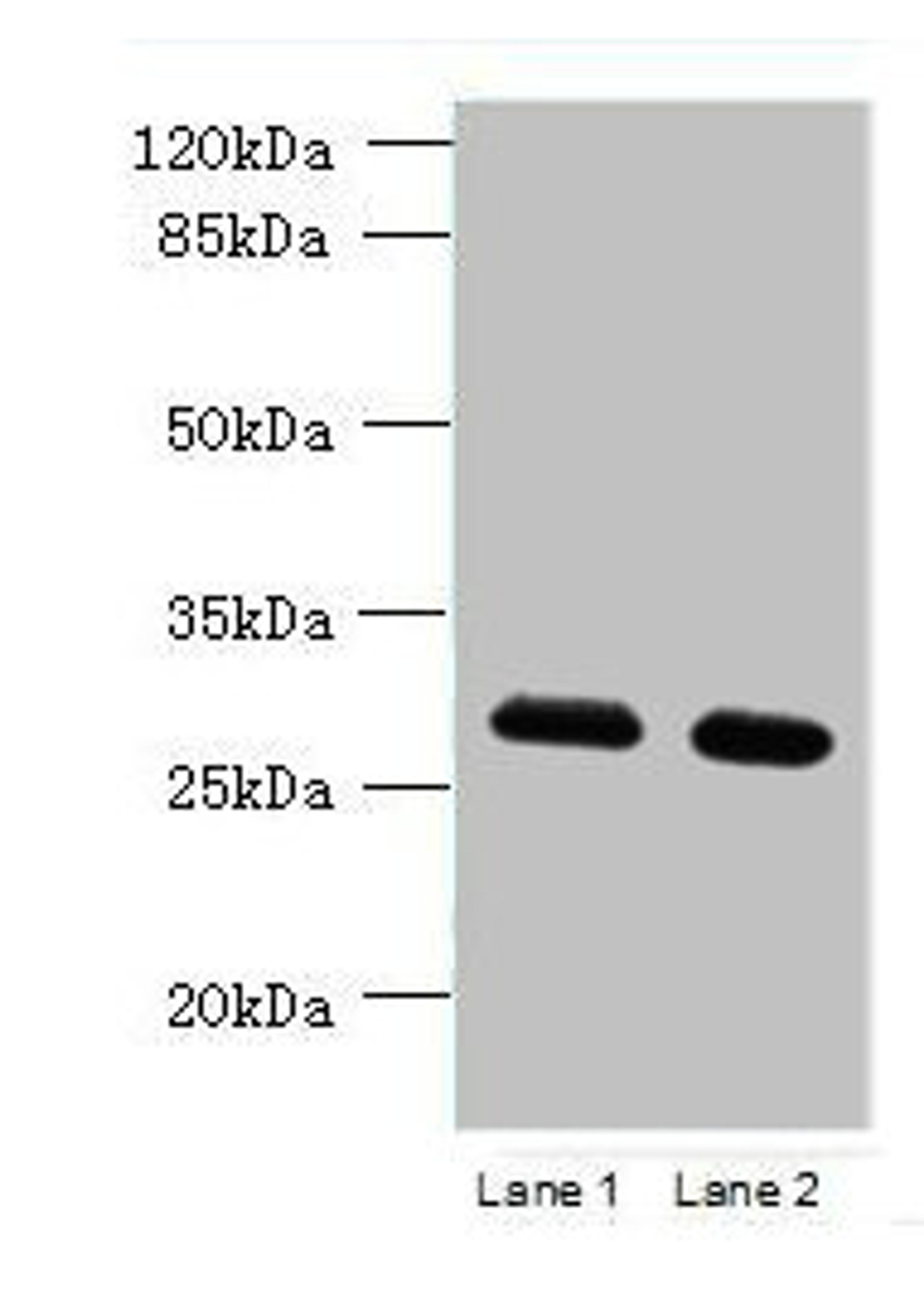 Western blot. All lanes: TMEM38B antibody at 1.5ug/ml. Lane 1: Mouse thymus tissue. Lane 2: Mouse liver tissue. Secondary. Goat polyclonal to rabbit IgG at 1/10000 dilution. Predicted band size: 33 kDa. Observed band size: 33 kDa.