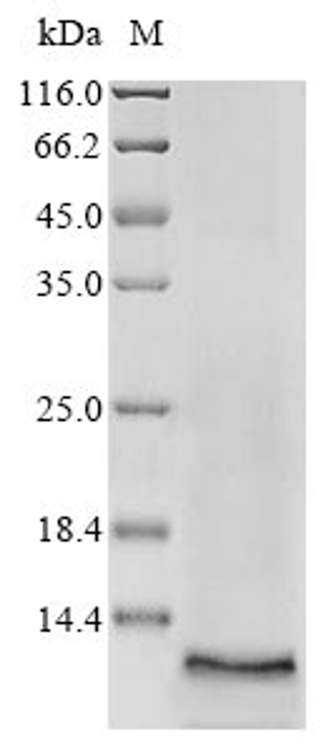 (Tris-Glycine gel) Discontinuous SDS-PAGE (reduced) with 5% enrichment gel and 15% separation gel.