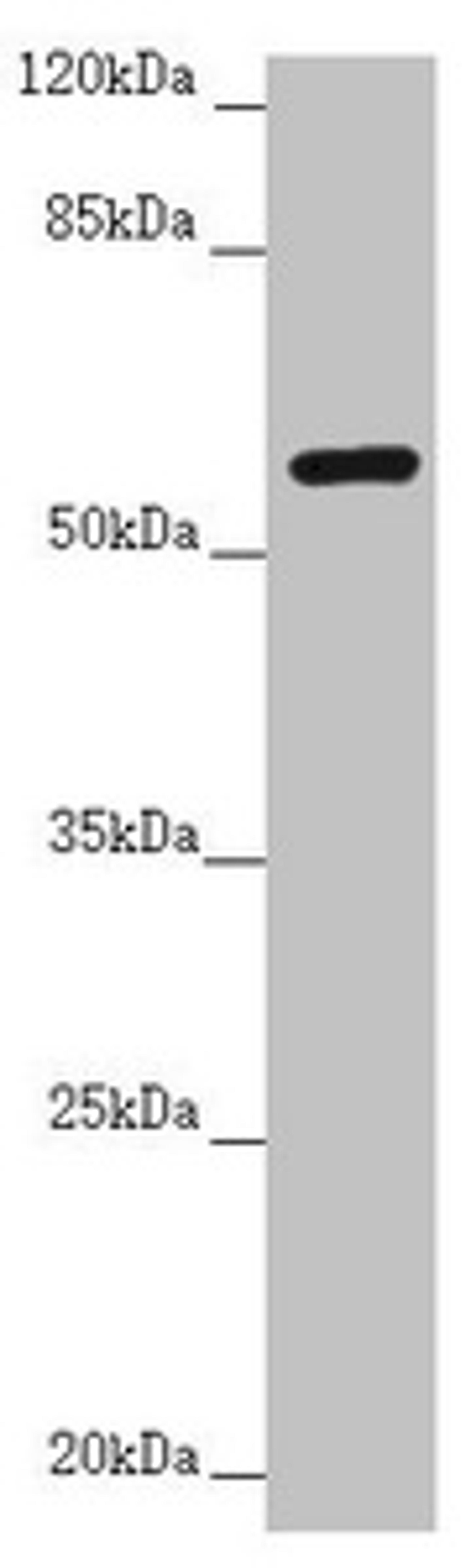 Western blot. All lanes: CEP57 antibody at 3.83µg/ml + CEM whole cell lysate. Secondary. Goat polyclonal to rabbit IgG at 1/10000 dilution. Predicted band size: 58, 55, 32, 57 kDa. Observed band size: 58 kDa