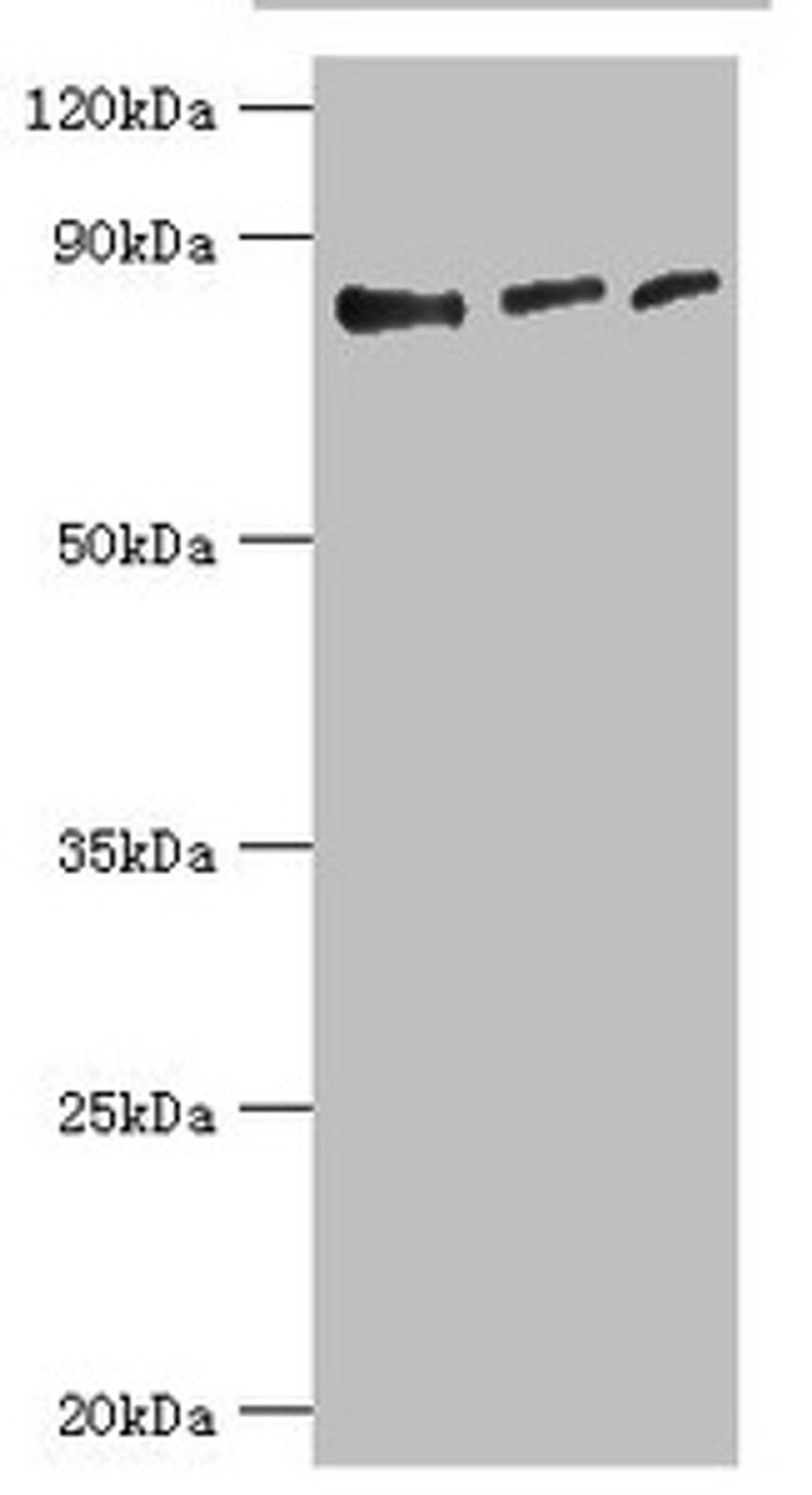 Western blot. All lanes: Histone-lysine N-methyltransferase EZH1 antibody at 4ug/ml. Lane 1: Hela whole cell lysate. Lane 2: HL60 whole cell lysate. Lane 3: Mouse gonad tissue. Secondary. Goat polyclonal to rabbit IgG at 1/10000 dilution. Predicted band size: 86, 87, 81, 77, 69 kDa. Observed band size: 86 kDa. 