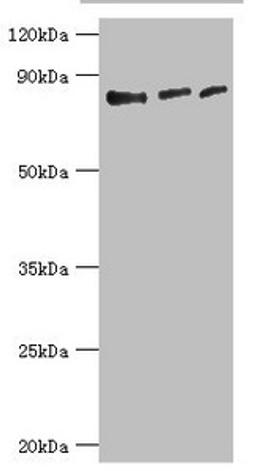 Western blot. All lanes: Histone-lysine N-methyltransferase EZH1 antibody at 4ug/ml. Lane 1: Hela whole cell lysate. Lane 2: HL60 whole cell lysate. Lane 3: Mouse gonad tissue. Secondary. Goat polyclonal to rabbit IgG at 1/10000 dilution. Predicted band size: 86, 87, 81, 77, 69 kDa. Observed band size: 86 kDa. 
