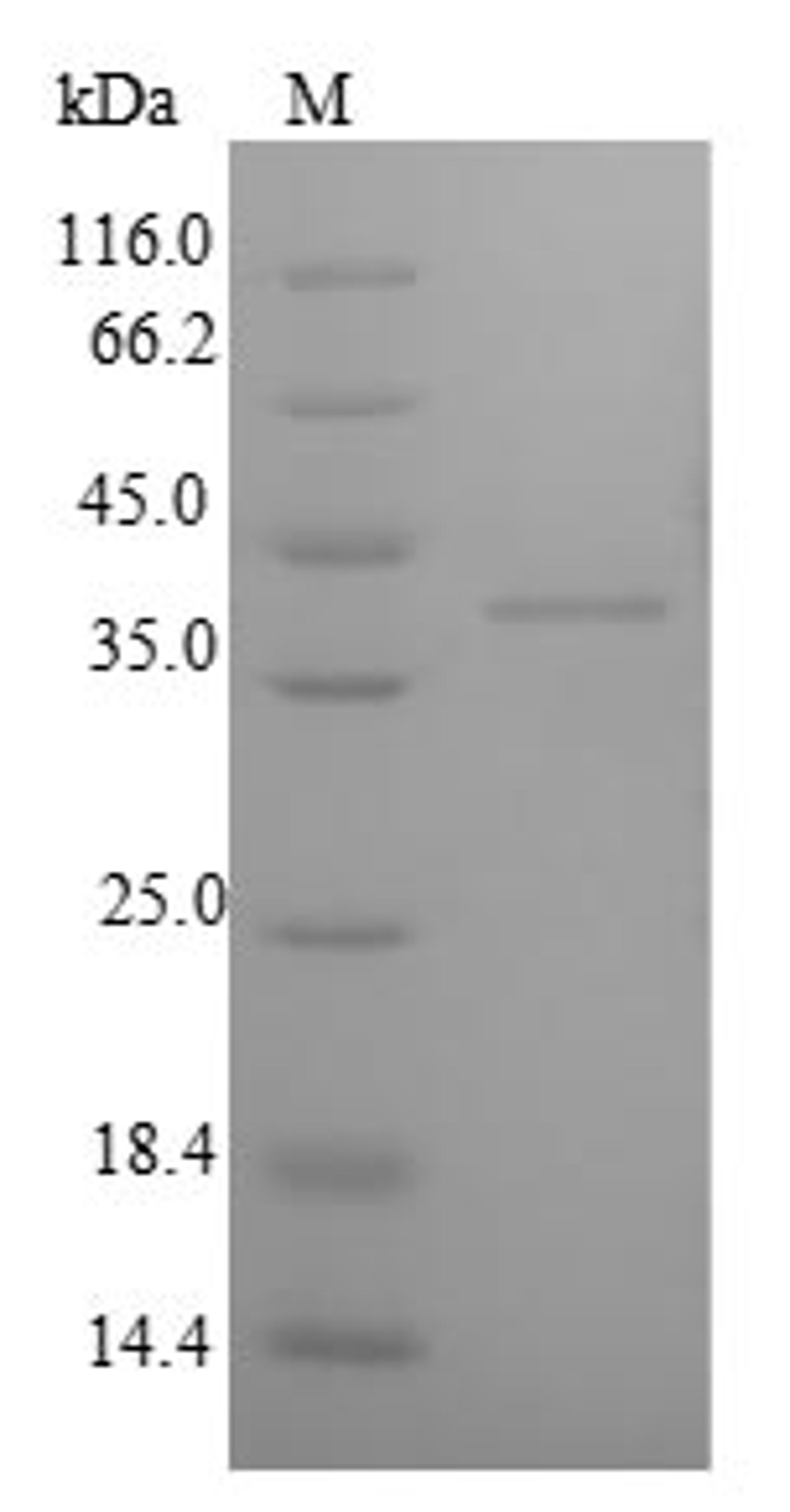 (Tris-Glycine gel) Discontinuous SDS-PAGE (reduced) with 5% enrichment gel and 15% separation gel.