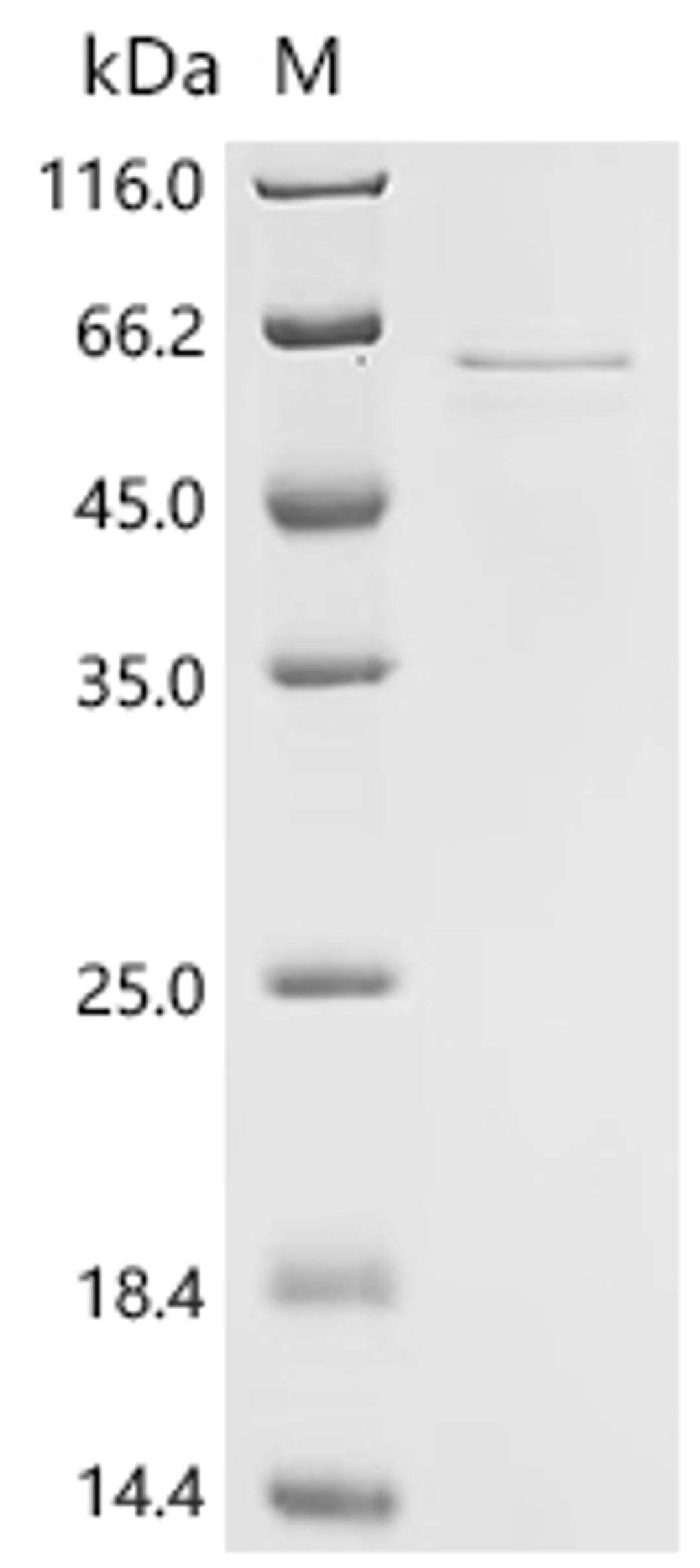 (Tris-Glycine gel) Discontinuous SDS-PAGE (reduced) with 5% enrichment gel and 15% separation gel.