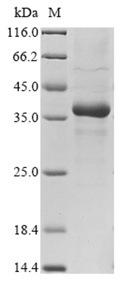 (Tris-Glycine gel) Discontinuous SDS-PAGE (reduced) with 5% enrichment gel and 15% separation gel.