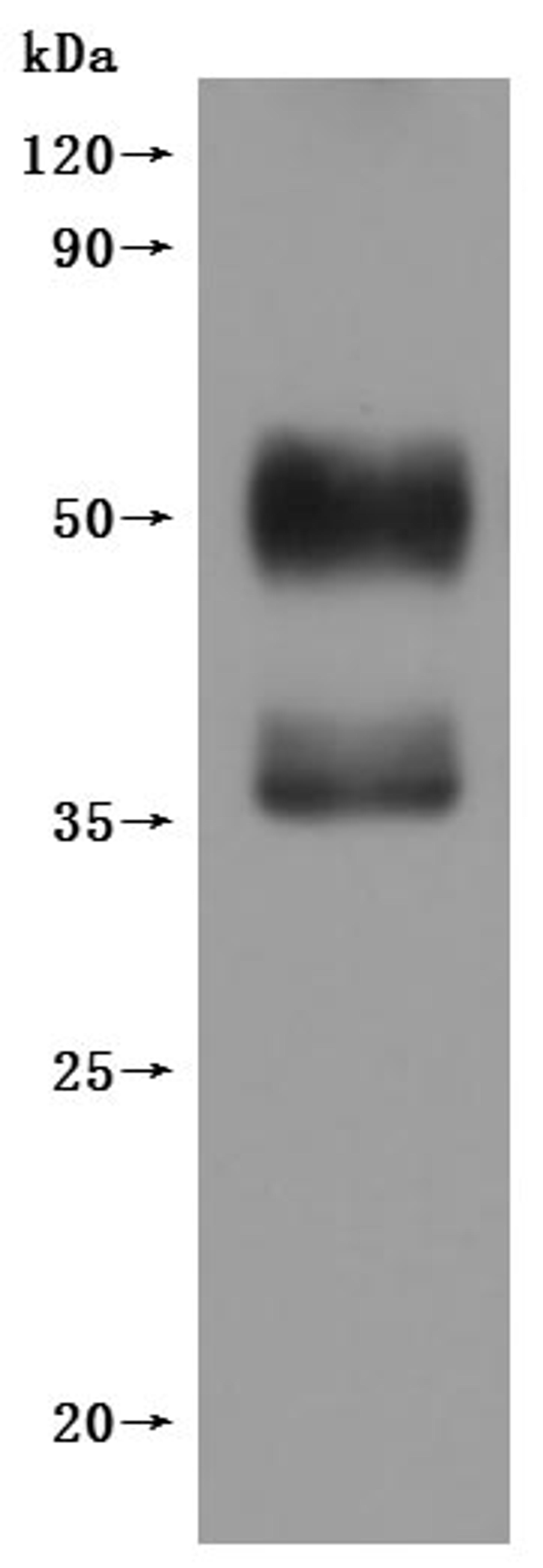 CSB-MP006254HU(F1) is detected by Mouse anti-6*His monoclonal antibody.