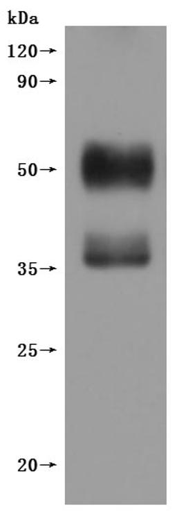 CSB-MP006254HU(F1) is detected by Mouse anti-6*His monoclonal antibody.