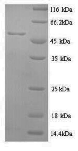 (Tris-Glycine gel) Discontinuous SDS-PAGE (reduced) with 5% enrichment gel and 15% separation gel.