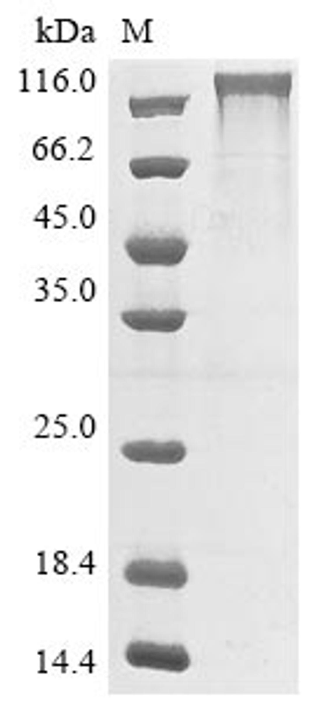 (Tris-Glycine gel) Discontinuous SDS-PAGE (reduced) with 5% enrichment gel and 15% separation gel.