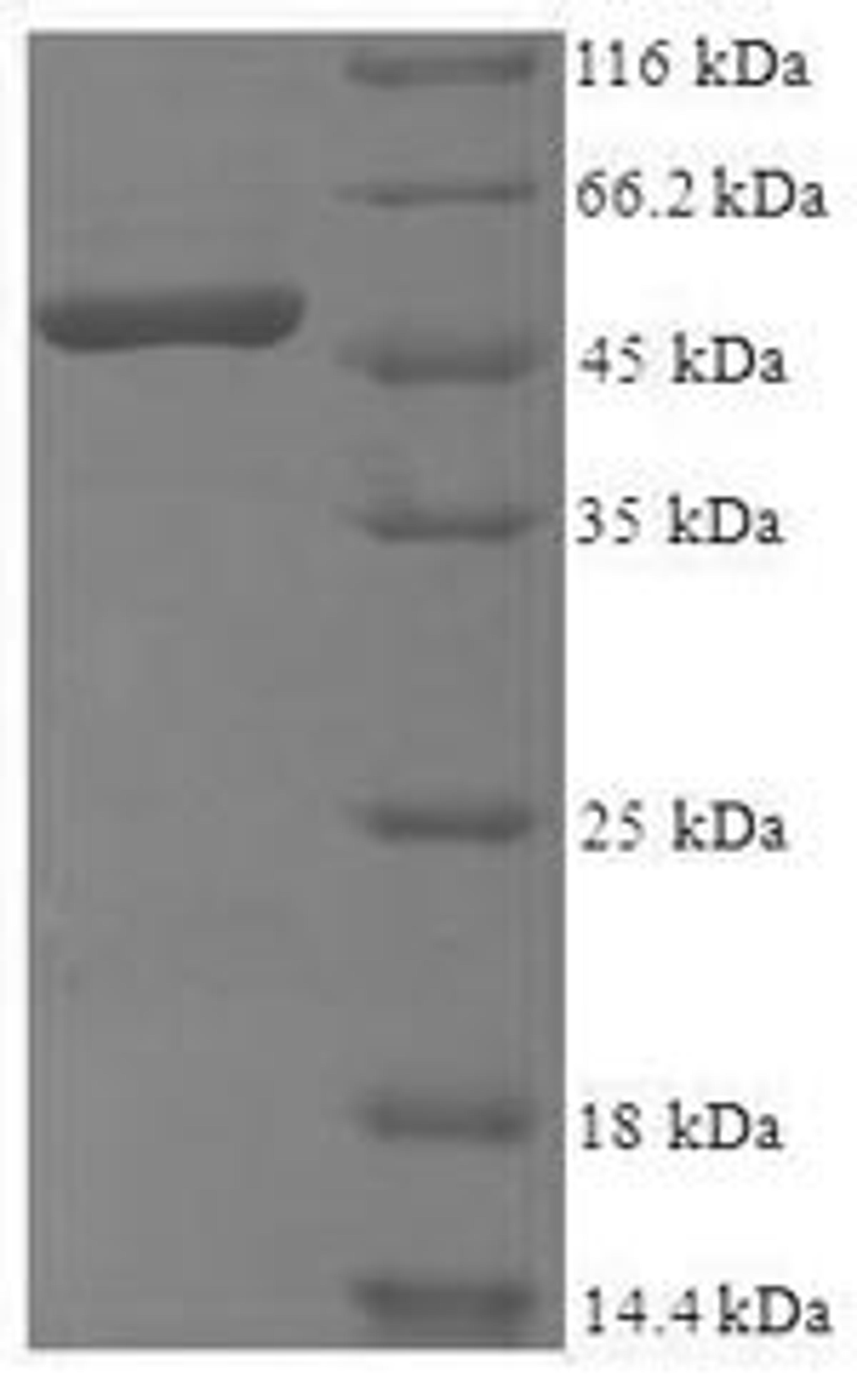 (Tris-Glycine gel) Discontinuous SDS-PAGE (reduced) with 5% enrichment gel and 15% separation gel.