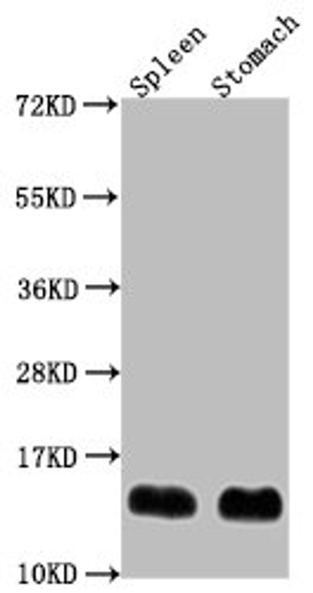 Western Blot. Positive WB detected in: Mouse spleen tissue, Mouse stomach tissue. All lanes: B2m antibody at 1:2000. Secondary. Goat polyclonal to rabbit IgG at 1/50000 dilution. Predicted band size: 14 kDa. Observed band size: 14 kDa. 