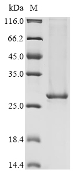(Tris-Glycine gel) Discontinuous SDS-PAGE (reduced) with 5% enrichment gel and 15% separation gel.